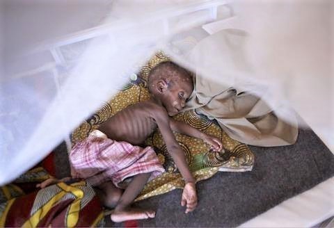 pict-餓死寸前の痩せ細った子供.jpg