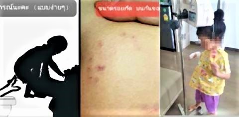 pict-Snake bites Bangkok 4 year old.jpg